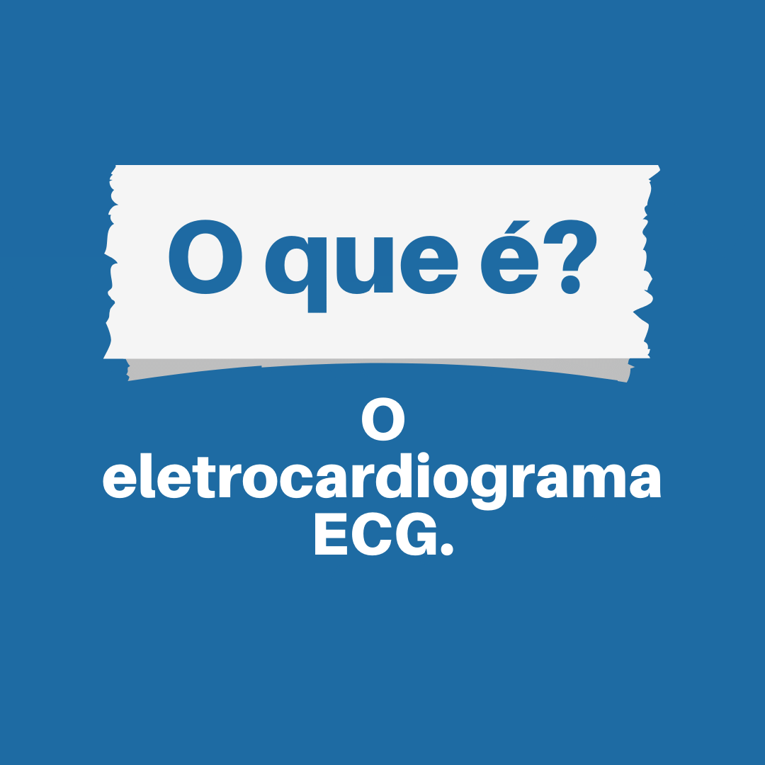 You are currently viewing O eletrocardiograma, ou ECG